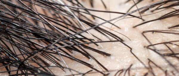 発毛のサイクルとは？3つの発毛周期と発毛期間